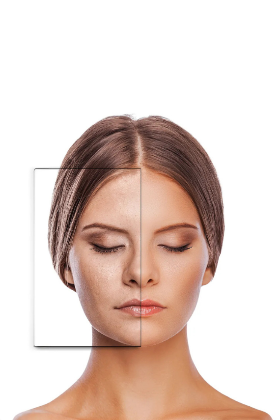 KRCDerma Neoccutane Yağlı ve Aknelli Cilde Yönelik Gece Tableti - 4